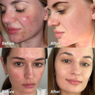 medicube Red Succinic Acid Serum 30mL MediCube