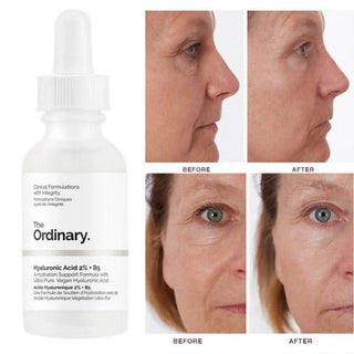 The Ordinary Hyaluronic Acid with 2% + B5 30mL The Ordinary