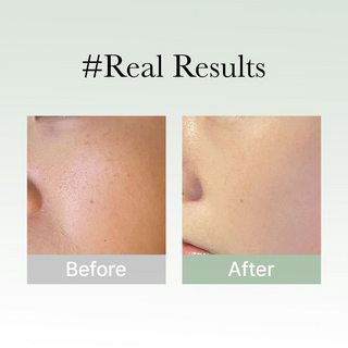 Arencia Holy Hyssop Serum 30, 50g Arencia