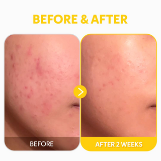 TIRTIR Pure Vitamin C 24% Face Serum 30mL TIRTIR