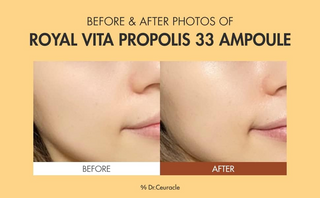 close-up of cheeks before and after using Dr.Ceuracle Royal Vita Propolis 33 Ampoule