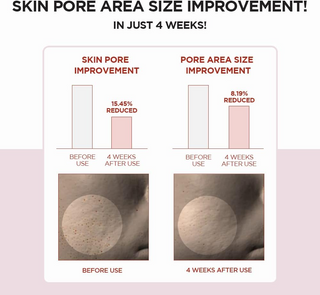 Skin1004 Madagascar Centella Poremizing Clear Toner 210mL Skin1004