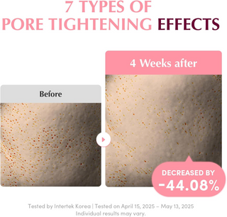 before and after comparision of pore tightening effects