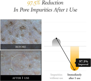 Aprilskin Calendula Peel Off Pore Minimizing Facial Mask 100g / 3.52Fl.oz