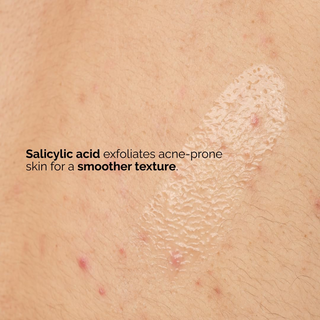 close-up of skin with The Ordinary Salicylic Acid 0.5% Body Serum swatch applied