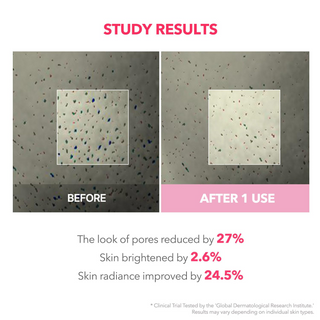 before and after comparision of pores  reduction on the skin.