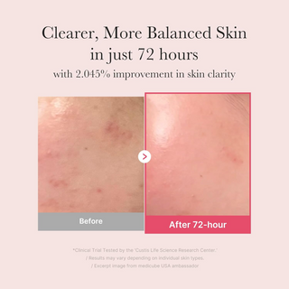 before and after comparison of skin clarity