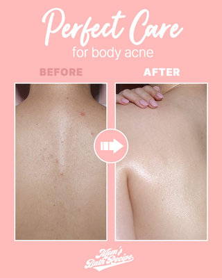 before and after comparision of using Mom’s Bath Recipe Body Peeling Pad Trouble Care