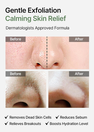 Before and after effects of gentle exfoliation