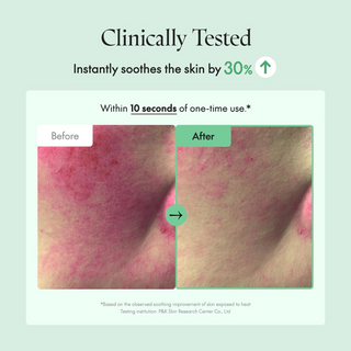 before and after skin comparision of skin soothness