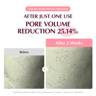 before and after comparision of pore volume reduction