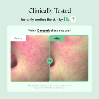 before and after skin comparision of skin soothness