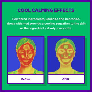 SKIN1004 Zombie Beauty Witch Pack (1 Box - 8ea) Skin1004