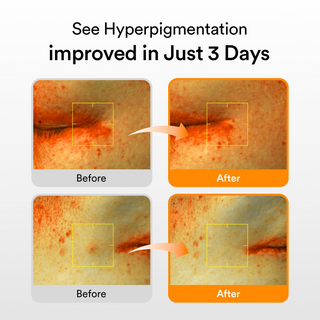 Abib Glutathiosome dark spot serum Vita drop 50mL Abib