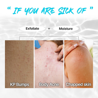 skin texture shows KP bumps, body acne and chapped skin