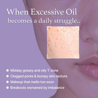 Close-up of skin with text about excessive oil and skin issues.