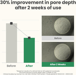 AXIS-Y LHA Peel & Fill Pore Balancing Cream | 50 ml / 1.69 fl. Oz. AXIS-Y