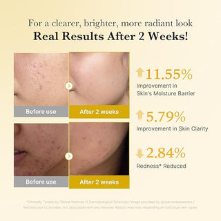 medicube Kojic Acid Turmeric Niacinamide Serum  30 mL