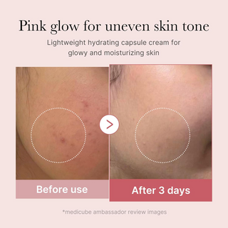 before and after comparison of uneven skin