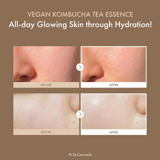 before and after comparision of Dr.Ceuracle Vegan Kombucha Tea Essence