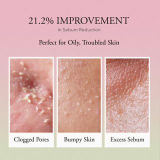 skin shows improvement in sebum reduction