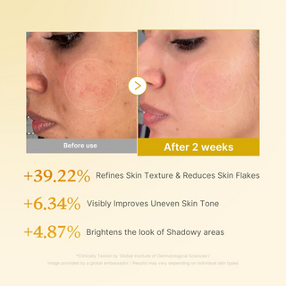 before and after skin texture, tone and brightness comparison