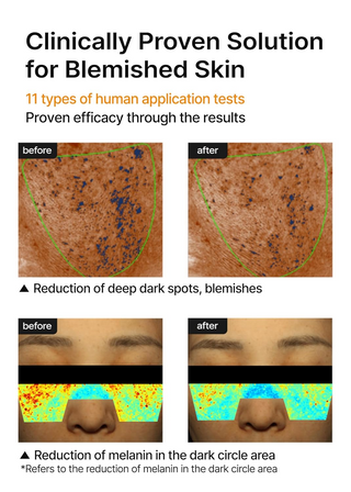 before and after comparision of blemished skin