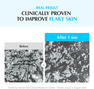 before and after comparision of flaky skin improvement