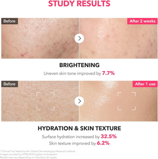 Before and after skin treatment results showing brightening and hydration improvements.