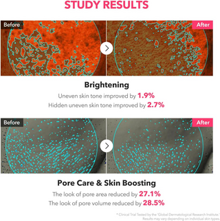Before and after study results for skin improvement with text indicating brightness and pore care.