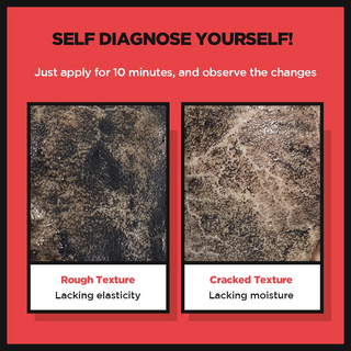 SKIN1004 Zombie Beauty Mummy Pack (1 Box - 8ea) Skin1004