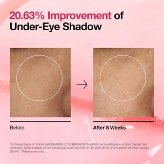 improvement comparision of under-eye shadow
