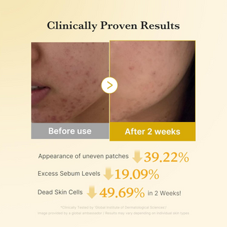 before and after comparison of medicube Kojic Acid Turmeric Pads on skin