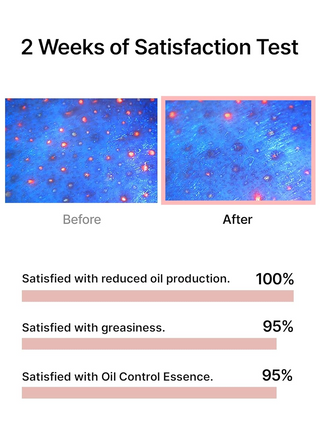 2 weeks of satisfaction test of celimax Oil Control Capsule Essence 30mL