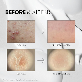 VT Mild Reedle Shot 50 50mL VT