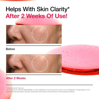 Anua Niacinamide 10% + TXA 4% Serum 30 mL Anua