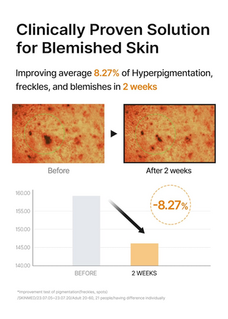 before and after comparison of blemished skin