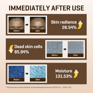 SOME BY MI Galactomyces Pure Vitamin C Glow Toner 200mL SOMEBYMI