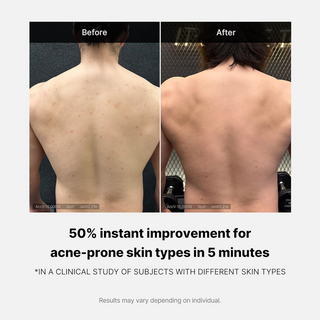 medicube Red Acne Body Wash 400g MediCube