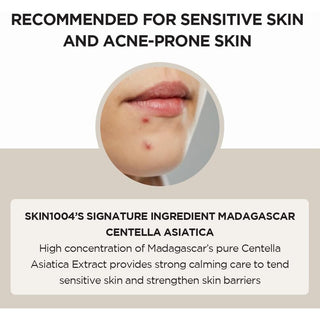 close-up of acne-proned skin