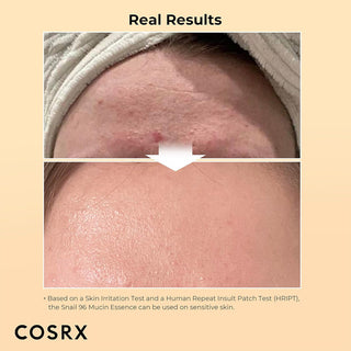 COSRX Advance Snail 96 Mucin Power Essence 100 mL Results