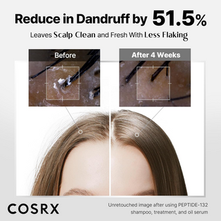 before and after comparision of reduction in dandruff