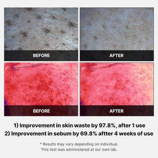 medicube Red Succinic Acid Peeling Pads 155g (70 Pads) MediCube