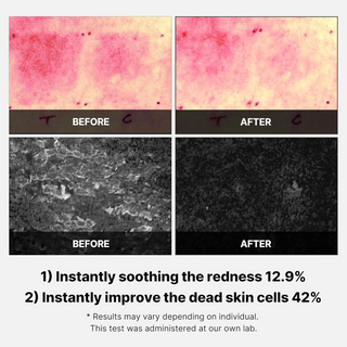 medicube Super Cica Pads (70 Pads) MediCube