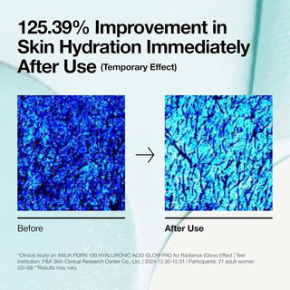 before and after skin hyderation comparision of anua glow pad