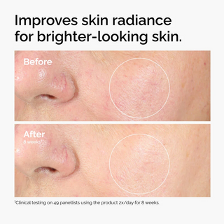 The Ordinary Alpha Arbutin 2% + HA 30mL The Ordinary