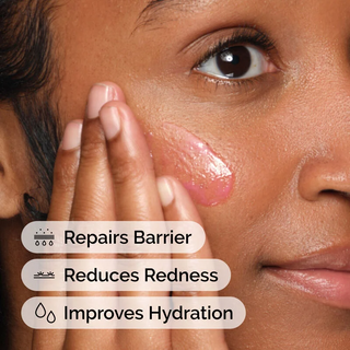 woman applying The Ordinary Soothing & Barrier Support Serum on her cheek