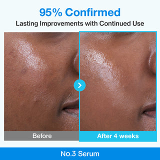 Numbuzin No.3 Blue Bio-Retinol Pore Refining Serum 30ml with 10% Niacinamide, Retinol and BHA for enlarged pores, uneven texture and smoother-looking skin in UAE.