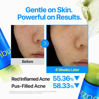 Numbuzin No.0 Zero Blemish Clarifying 2% Sulfur Cleansing Foam 150ml with Salicylic Acid, PHA and Centella for oily, blemish-prone skin and clogged pores in UAE.