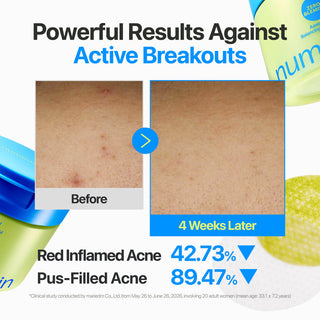 Numbuzin No.0 Zero Blemish Azela Cica Balancing Dual Pads 60EA with Azelaic Acid, BHA, PHA, Hypochlorous Acid and Centella for acne, clogged pores and excess oil in UAE.